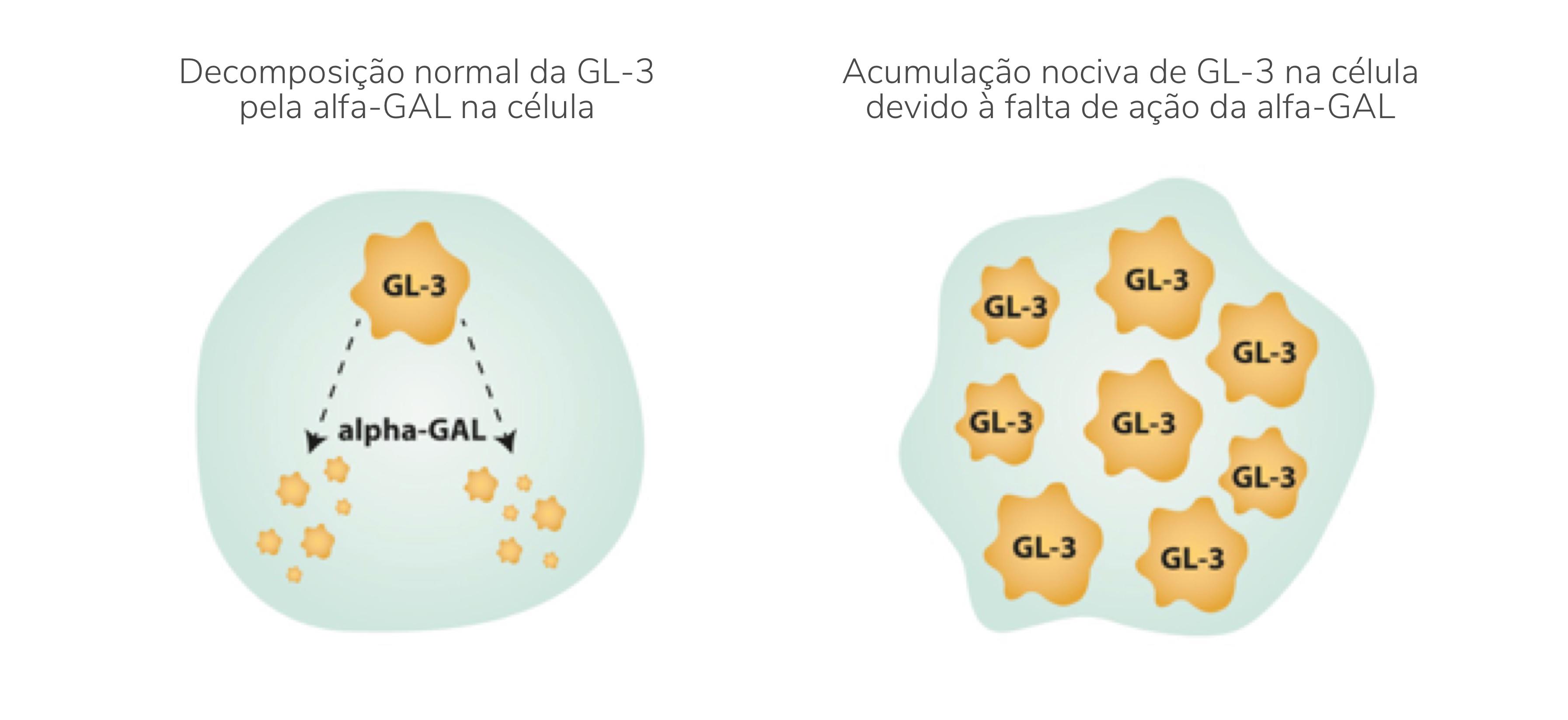 Acumulação de GL-3 devido à falta de alfa-GAL